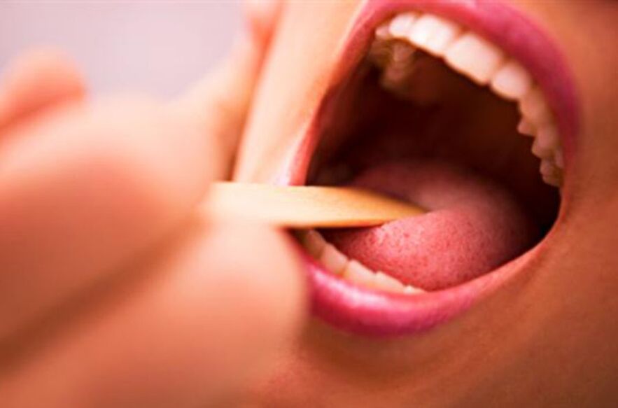 პარაზიტების ტიპები ადამიანის პირში